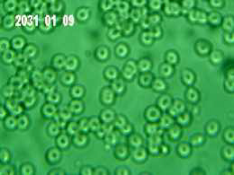 baseline blood