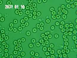 baseline blood_3