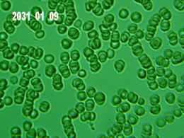 baseline blood_4