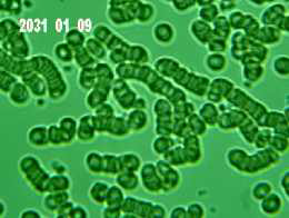 baseline blood_5
